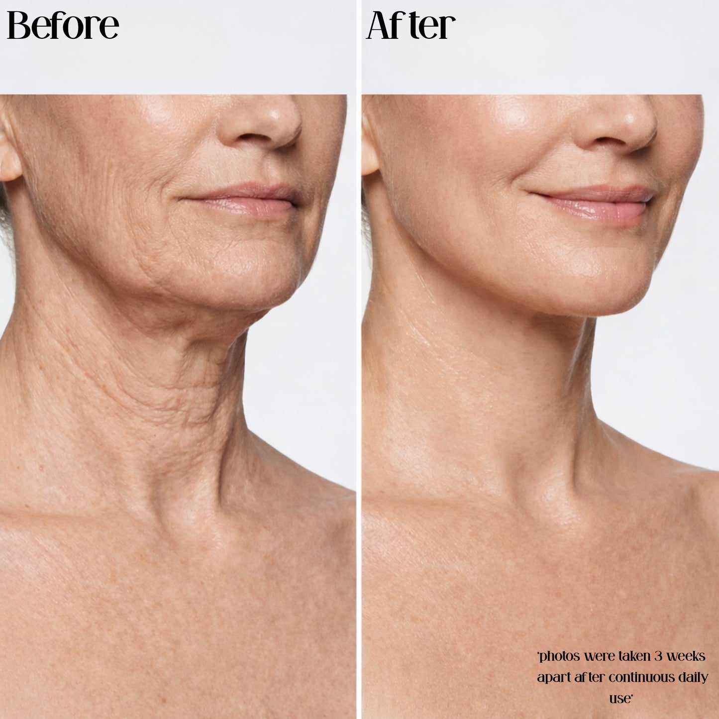 Firming Collagen Serum™